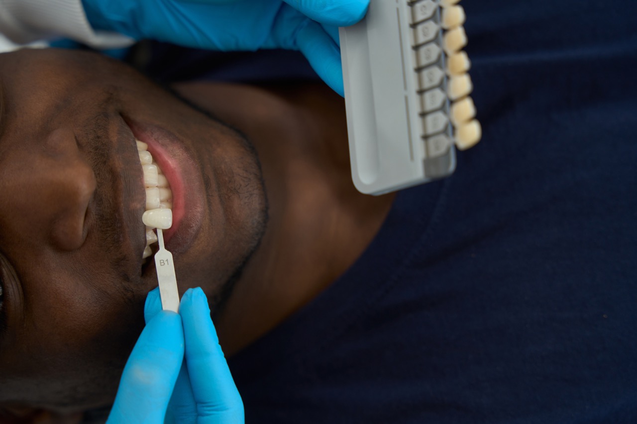 Doctor in protective gloves trying to make a selection of veneer color